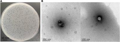 Characteristics of a Bacteriophage, vB_Kox_ZX8, Isolated From Clinical Klebsiella oxytoca and Its Therapeutic Effect on Mice Bacteremia